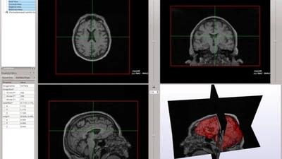 CamiTK : un atelier pour prototyper des applications médicales featured image