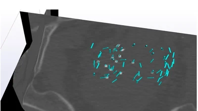 Medical Image Analysis featured image