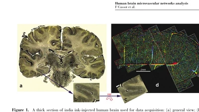 A Novel Three-Dimensional Computer-Assisted Method for a Quantitative Study of Microvascular Networks of the Human Cerebral Cortex featured image