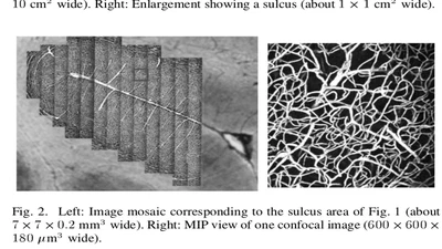 Blockwise processing applied to brain microvascular network study featured image