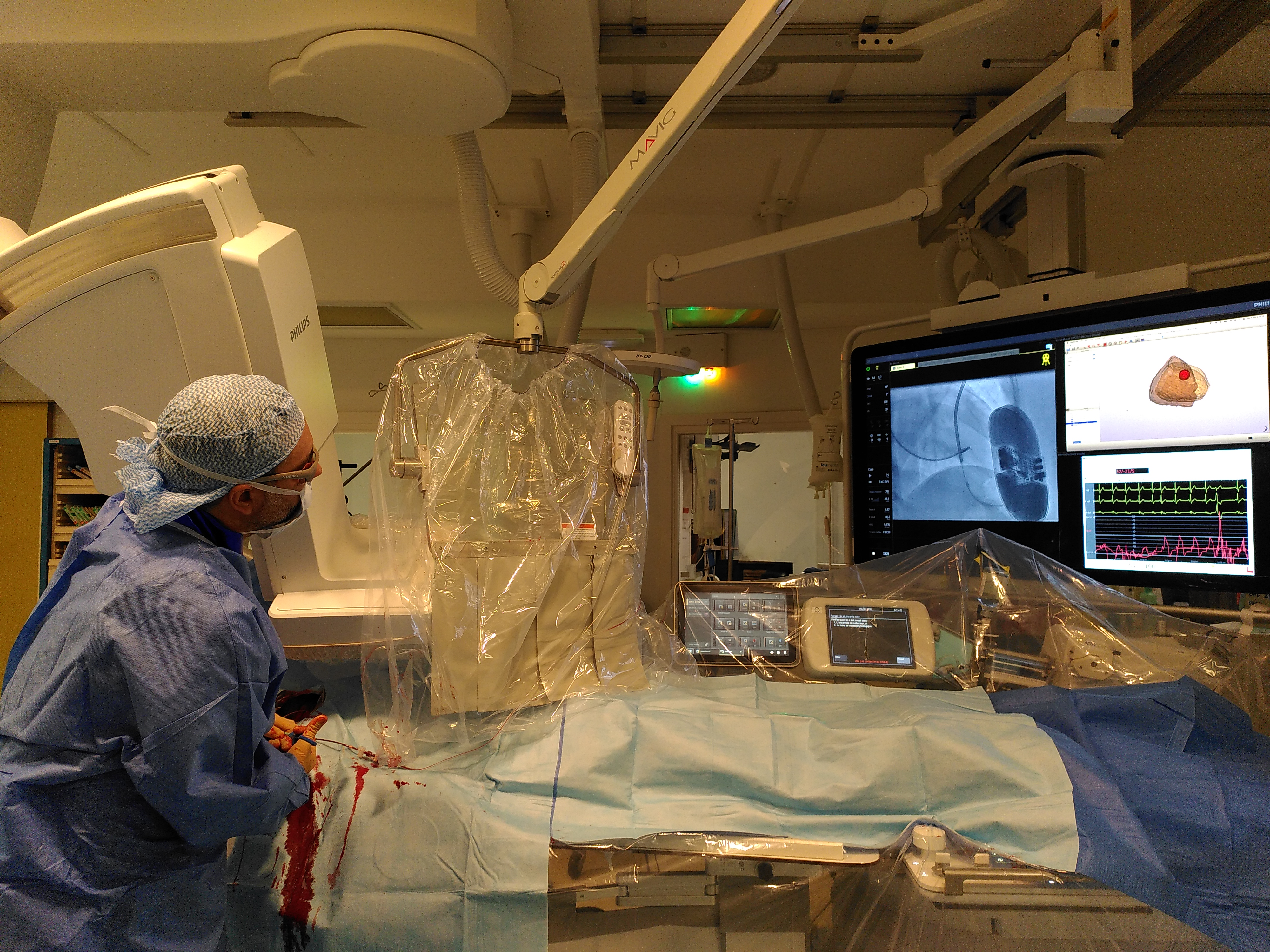 Image-guided interventional cardiology in the cath lab