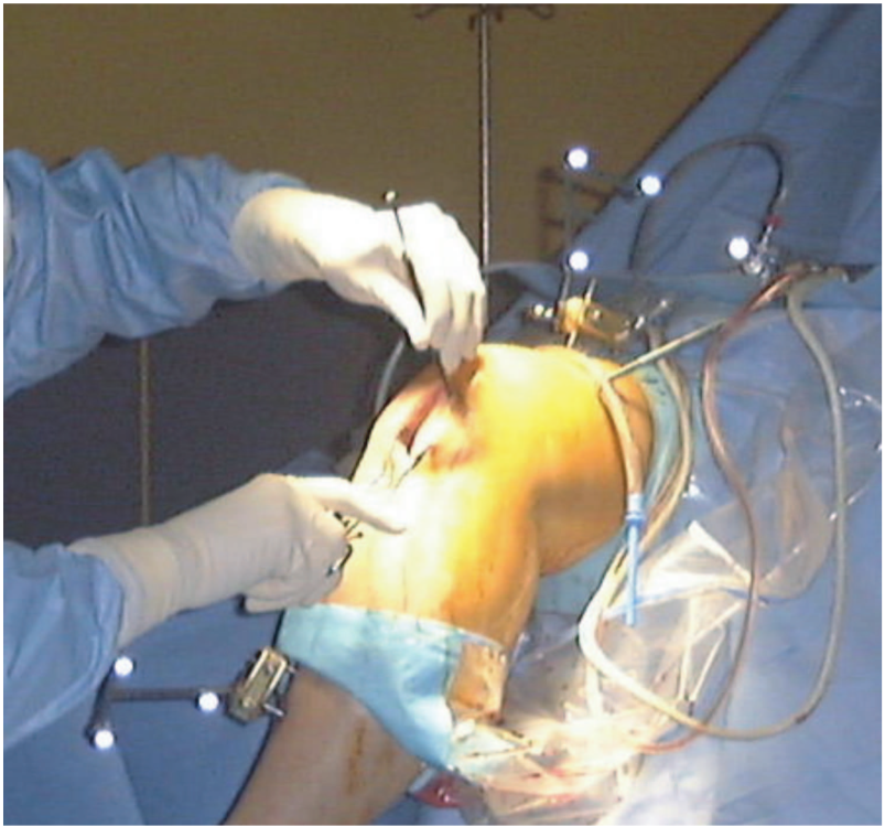 Ultrasound-guided orthopaedic intervention: the clinical context
