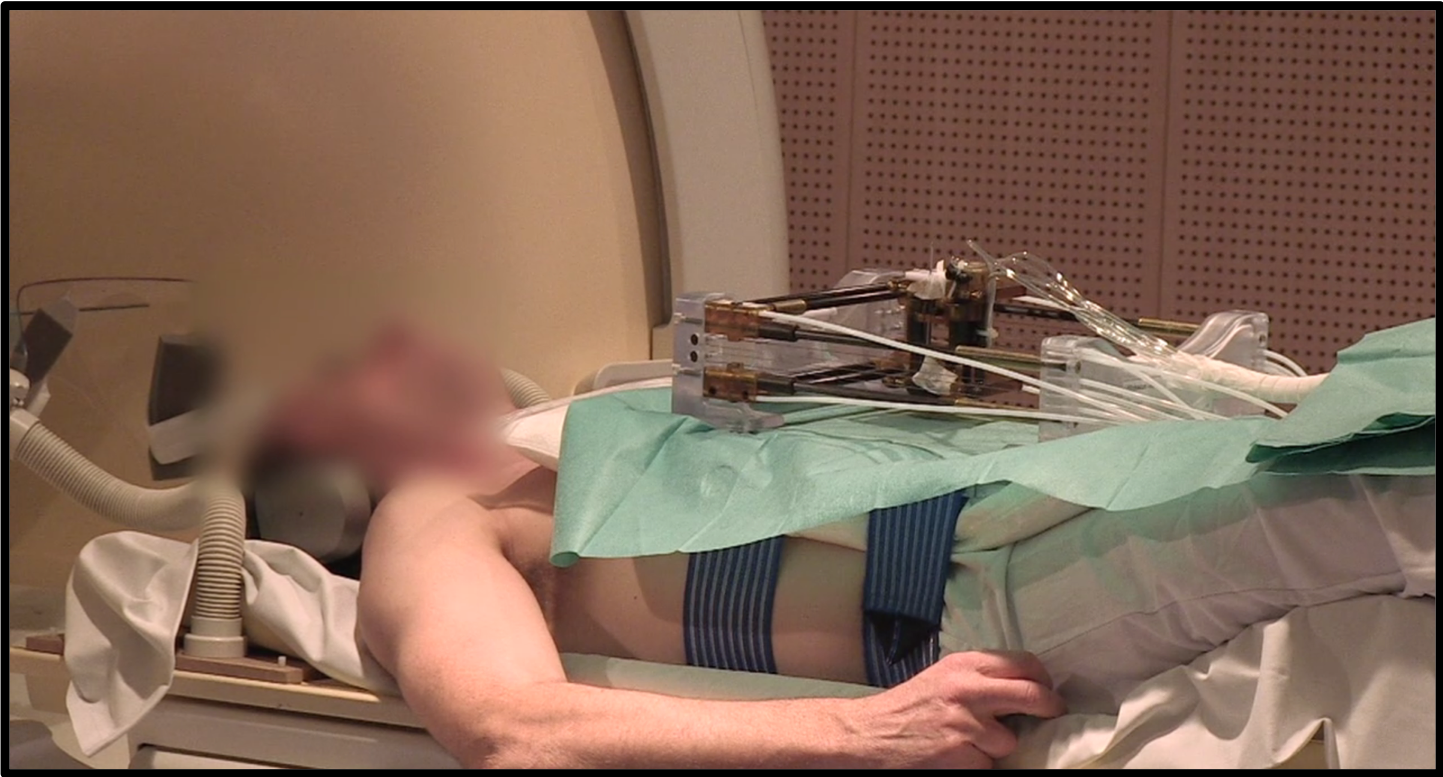 The LPR β prototype placed on a healthy subject at the MRI tunnel entrance during preclinical trials