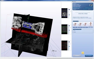 The LPR shown as a CAD model registered in the MRI image, inside the CamiTK guidance software rebuilt under quality assurance — the redesign was also a software one
