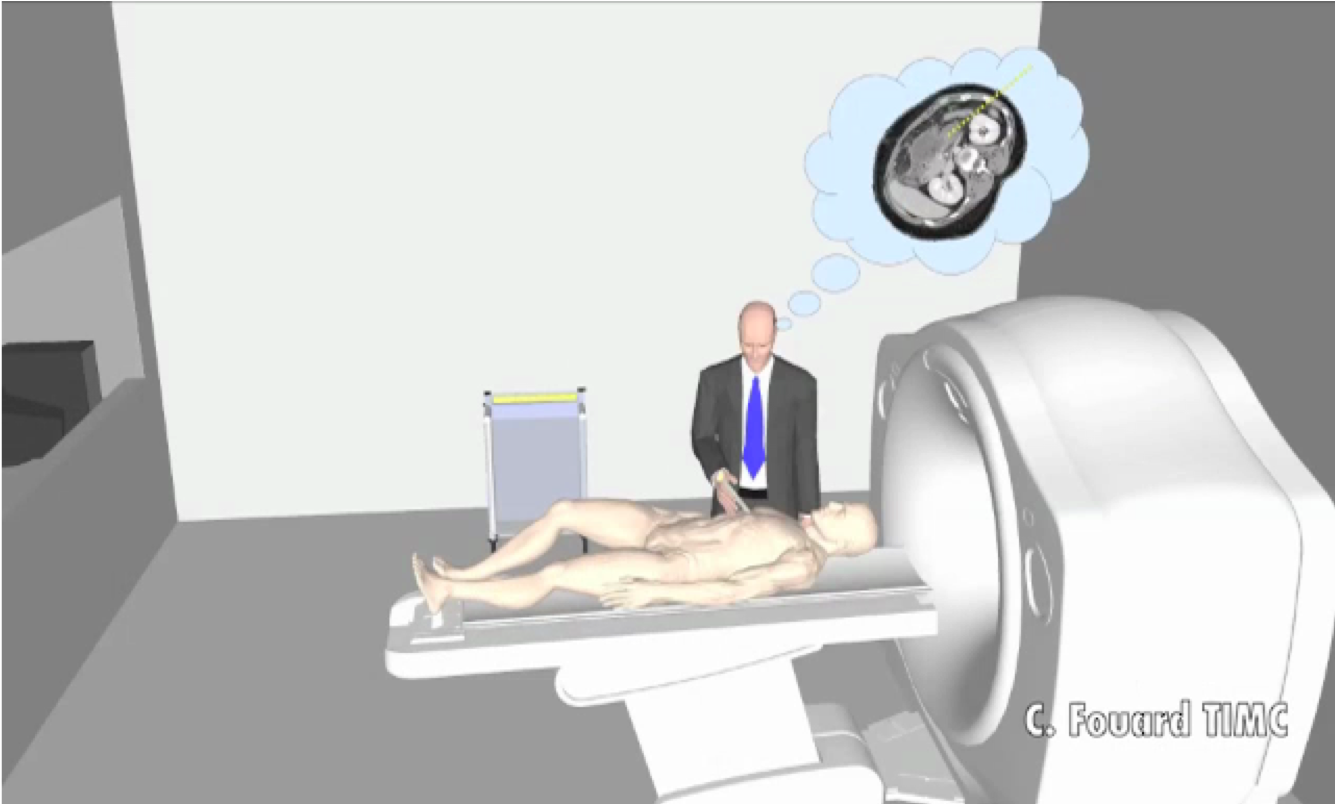 The radiologist memorises the slice on which the needle trajectory was planned