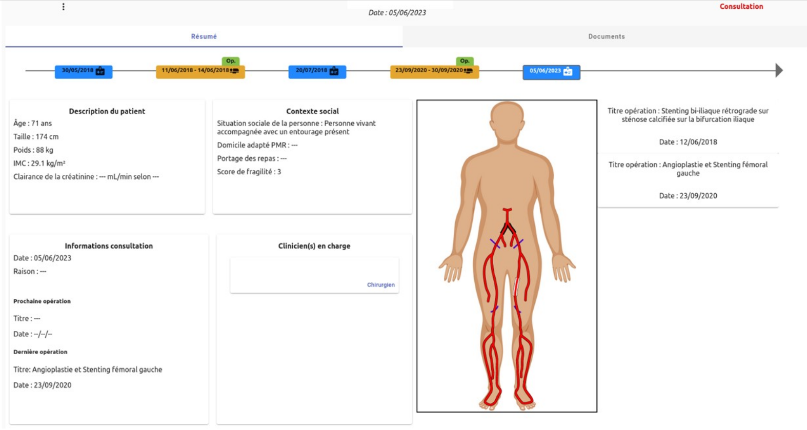 Interface of the prototype data-collection software (fig. 3.11, M. Roux thesis).