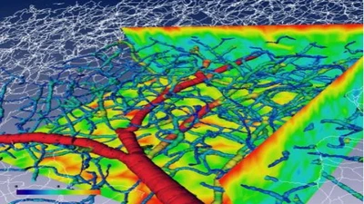 Extraction of morphometric parameters for the study of the cerebral micro-vascular network featured image