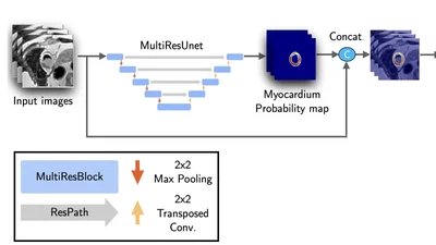 Segmentation of cardiac infarction in delayed-enhancement MRI using probability map and transformers-based neural networks featured image